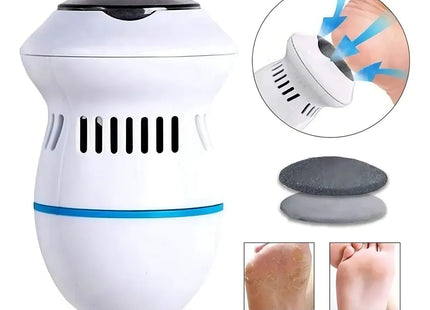 Removedor de Callos Eléctrico - Callus Remover con Aspiradora Integrada
