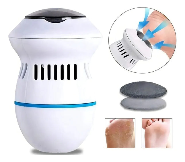 Removedor de Callos Eléctrico - Callus Remover con Aspiradora Integrada